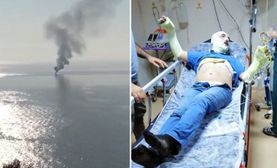 MHP İlçe Başkanı teknede çıkan yangında yaralandı